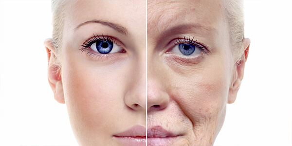 Skin Rejuvenation before and after